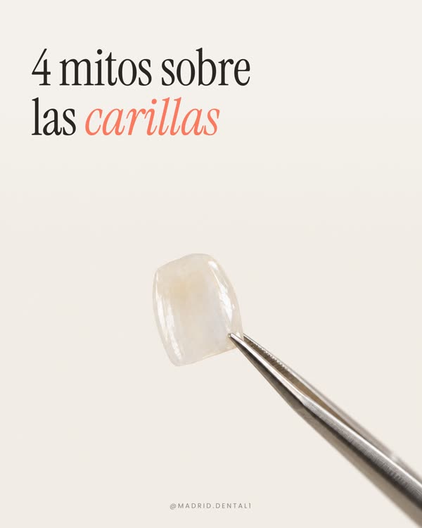 Carrusel sobre mitos de las carillas, diapositiva 1 de 8